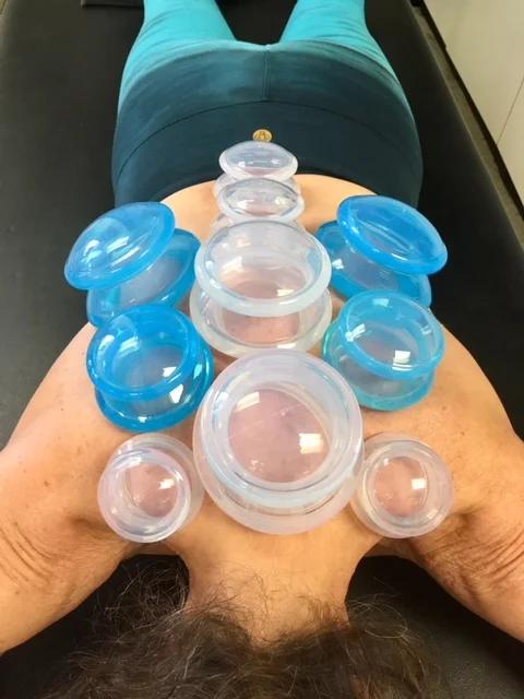 Cupping therapy cups